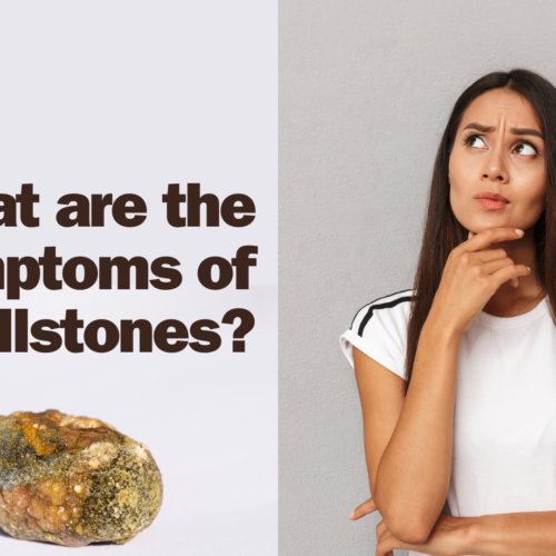 What are the Symptoms of Gallstones?