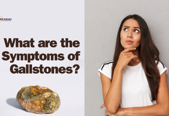 What are the Symptoms of Gallstones?