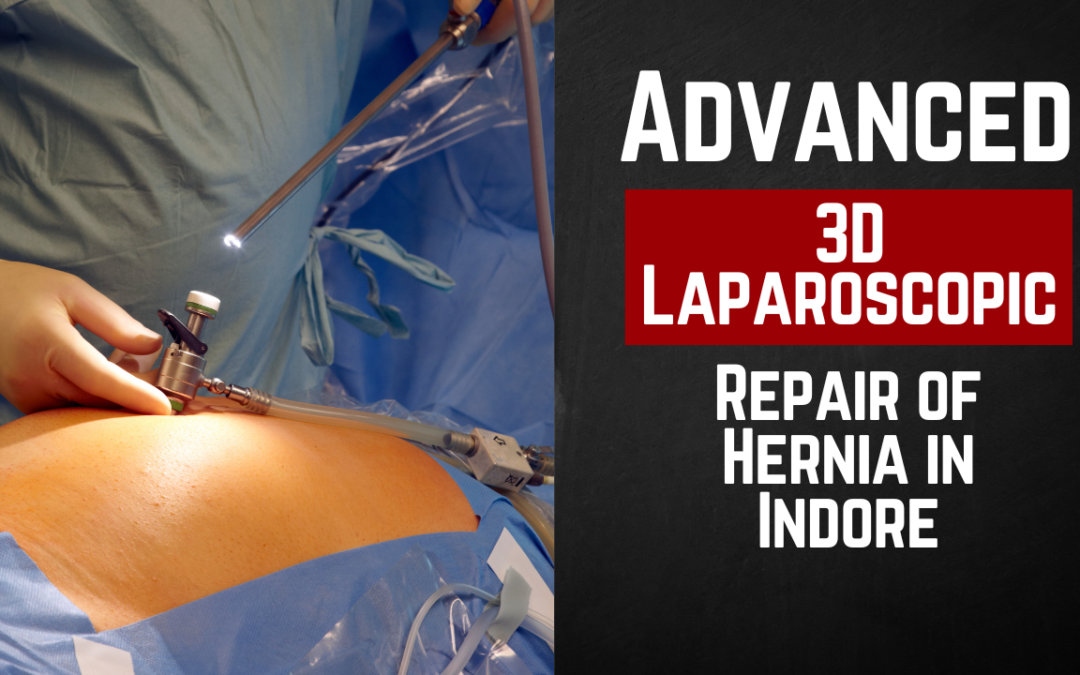 Advanced 3D Laparoscopic Repair of Hernia in Indore: The Future of Surgery