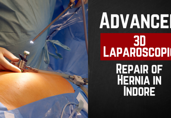 Advanced 3D Laparoscopic Repair of Hernia in Indore: The Future of Surgery