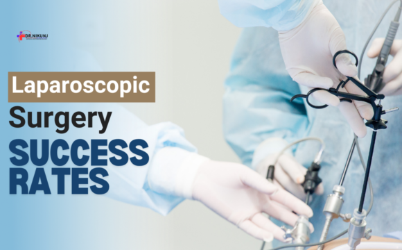 Laparoscopic Surgery Success Rates: Benefits, Statistics, and What to Expect