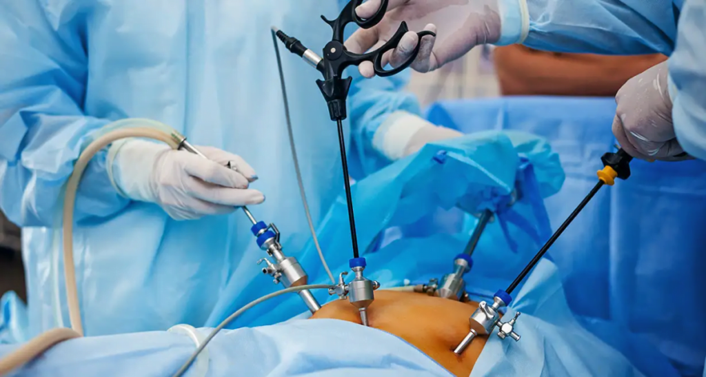 Improving Patient Outcomes in Laparoscopic Procedures: Benefits, Risks, and Success Factors