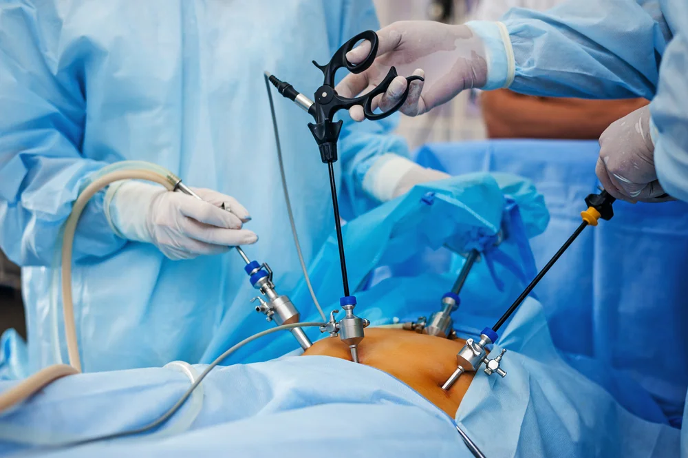 Comprehensive Postoperative Care for Laparoscopic Patients: Key Tips for Recovery