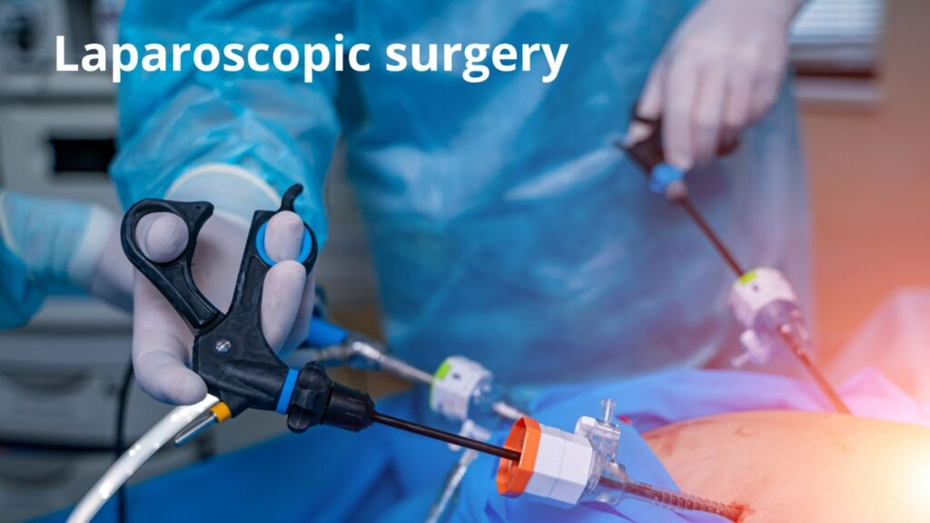 The Cost-Effectiveness of Laparoscopic Surgery: A Comprehensive Guide to Savings and Benefits