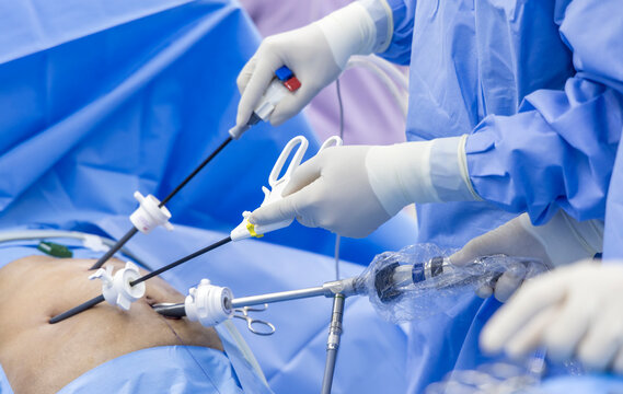 The Cost-Effectiveness of Laparoscopic Surgery: A Comprehensive Guide to Savings and Benefits