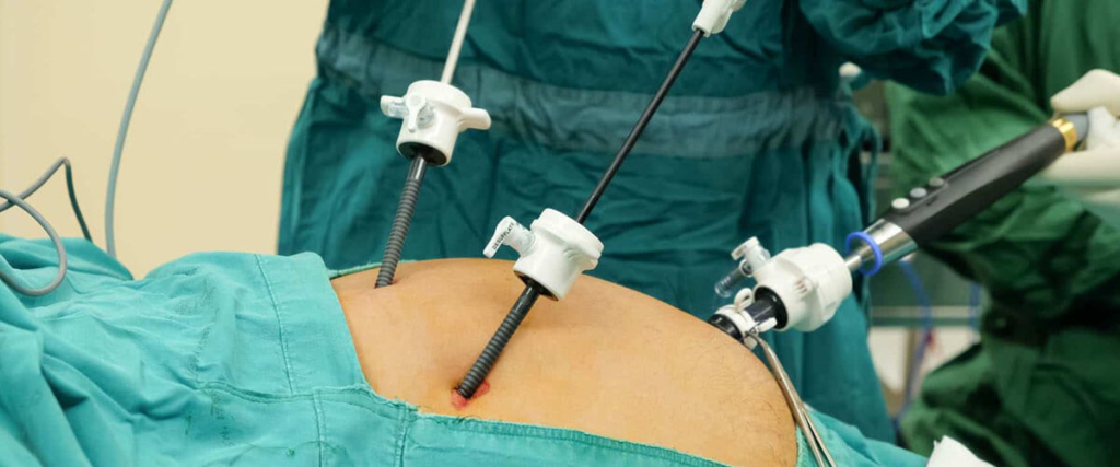 The Cost-Effectiveness of Laparoscopic Surgery: A Comprehensive Guide to Savings and Benefits