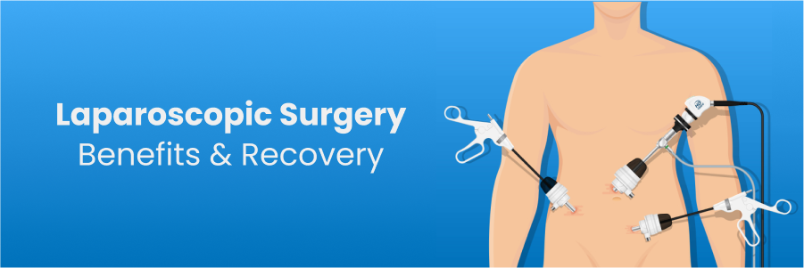 Quick and Smooth Recovery After Laparoscopic Surgery: Timeline and Tips