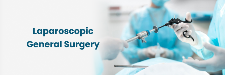 Quick and Smooth Recovery After Laparoscopic Surgery: Timeline and Tips