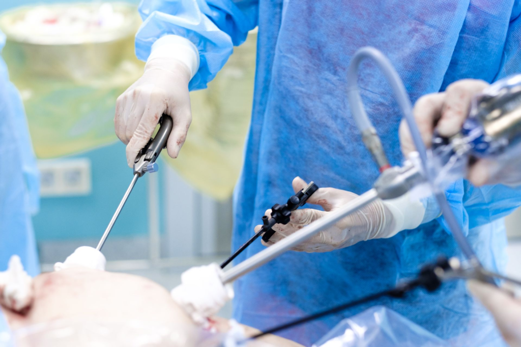 Improving Patient Outcomes in Laparoscopic Procedures: Benefits, Risks, and Success Factors