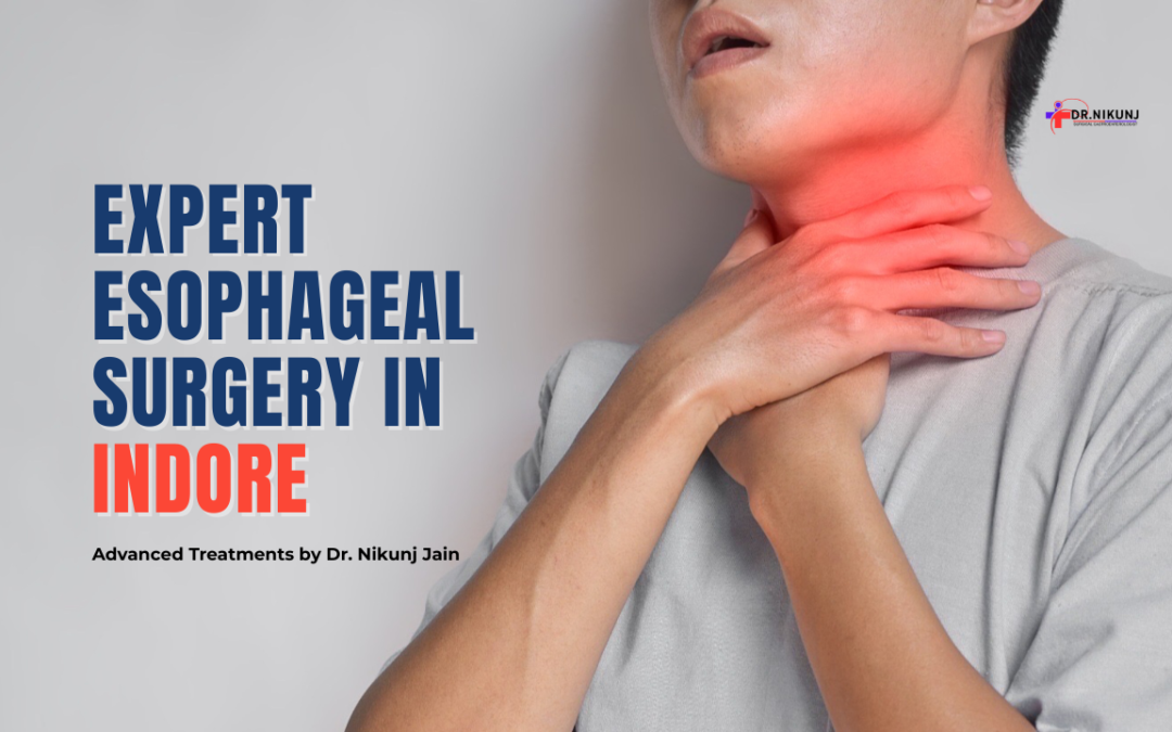 Esophageal Surgery in Indore