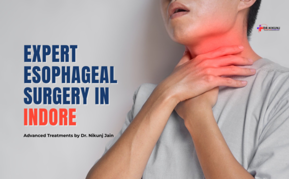Esophageal Surgery in Indore