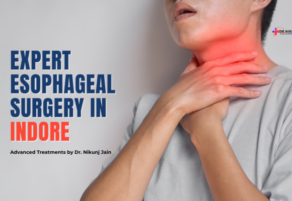 Esophageal Surgery in Indore