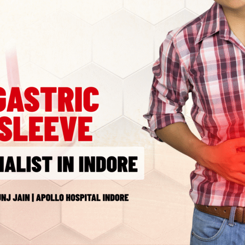 Gastric Sleeve Specialist in Indore
