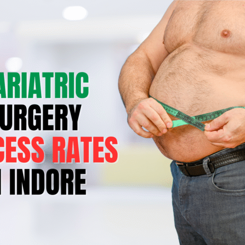 Bariatric Surgery Success Rates in Indore