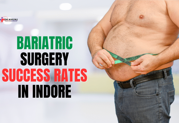 Bariatric Surgery Success Rates in Indore