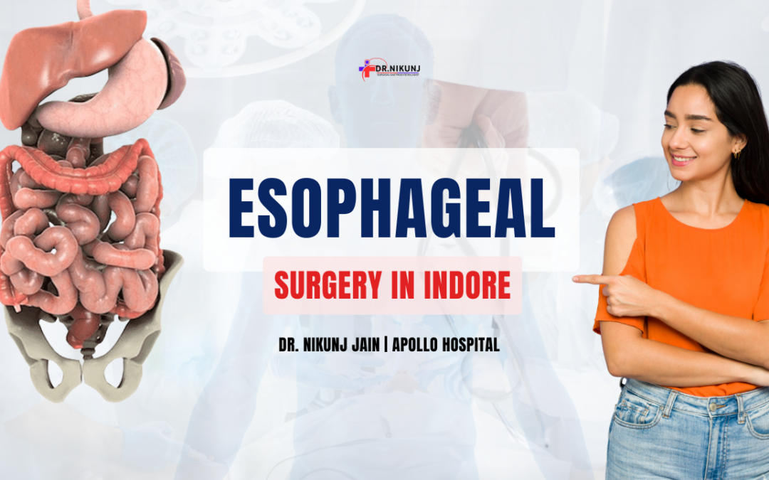 Esophageal Surgery in Indore | Dr. Nikunj Jain | Apollo Hospital