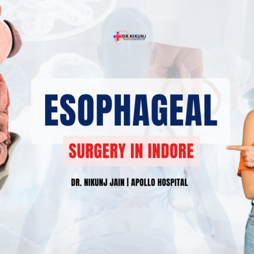Esophageal Surgery in Indore