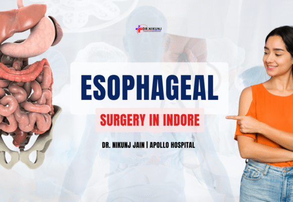 Esophageal Surgery in Indore