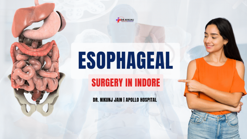 Esophageal Surgery in Indore