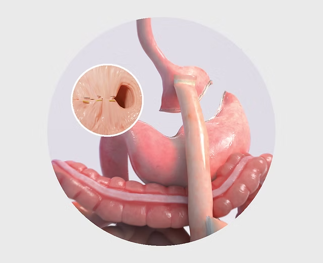 Best Bariatric Surgeon in Indore | Dr. Nikunj Jain | Apollo Hospital 4 Best Bariatric Surgeon in Indore