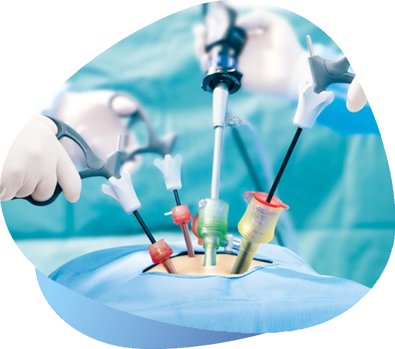 Laparoscopic Surgery Cost in Indore | Dr. Nikunj Jain | Apollo Hospital 3 Laparoscopic Surgery Cost in Indore