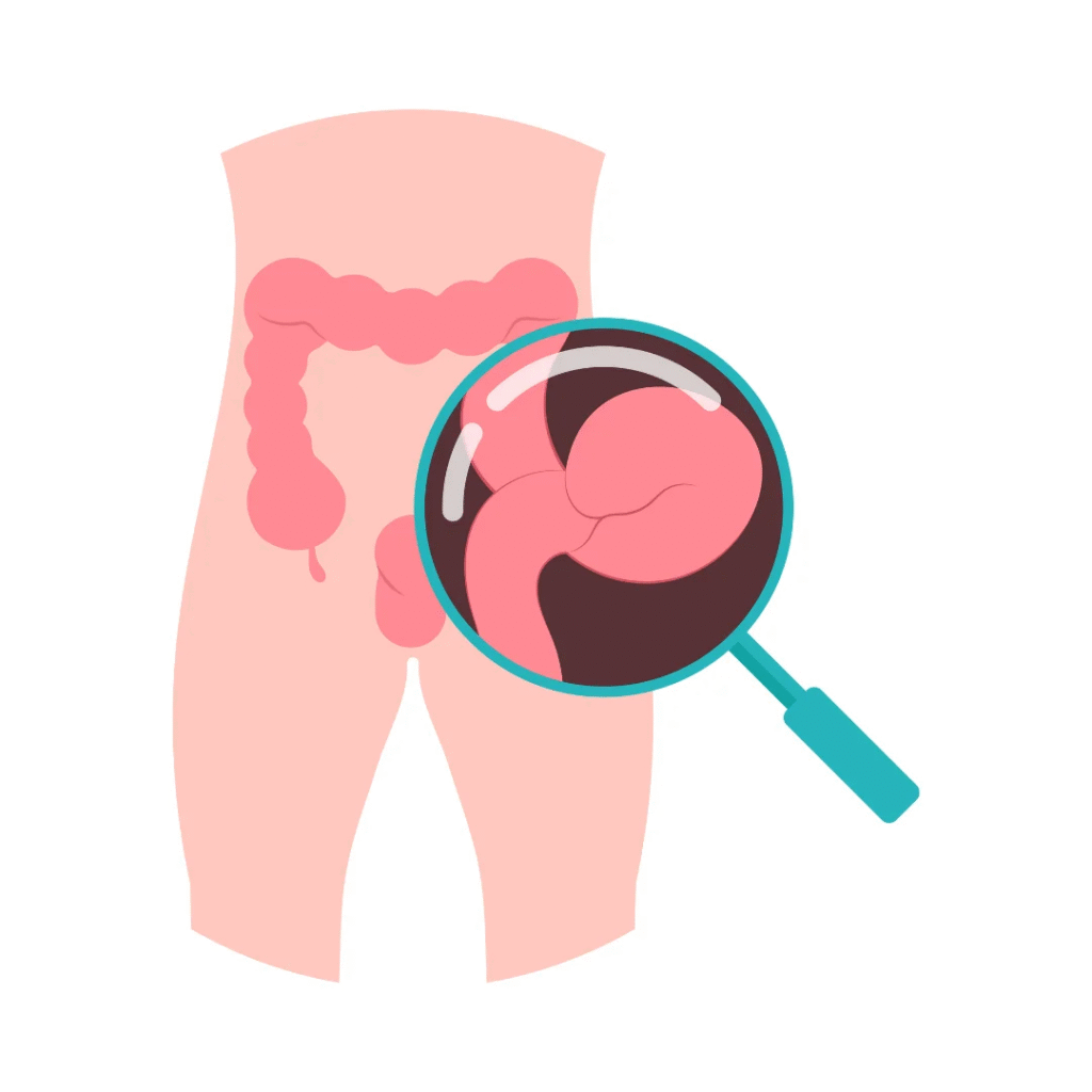 Best Hernia Surgeon in Indore | Dr. Nikunj Jain | Apollo Hospital 2 Best Hernia Surgeon in Indore