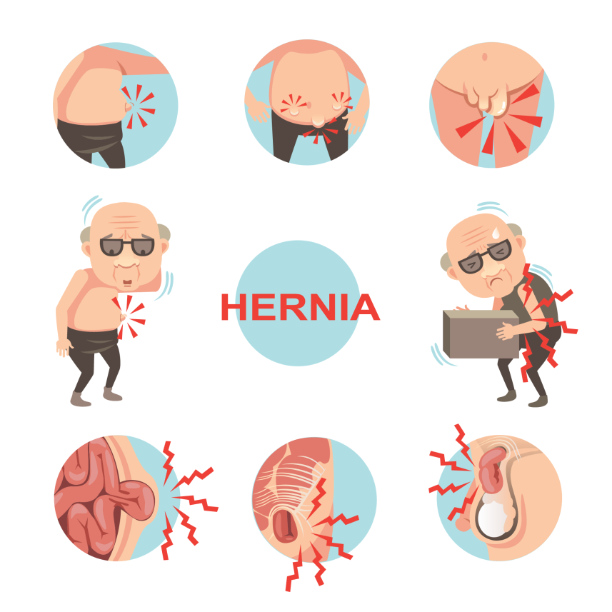 Best Hernia Surgeon in Indore | Dr. Nikunj Jain | Apollo Hospital 4 Best Hernia Surgeon in Indore