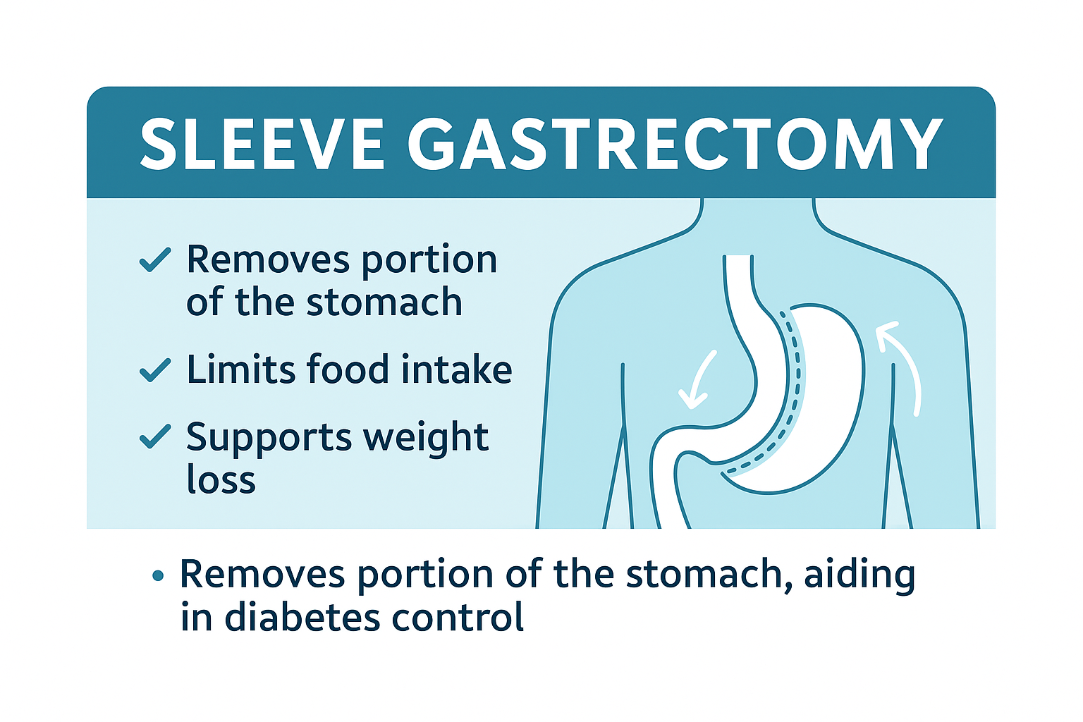 Sleeve Gastrectomy 1 image 1