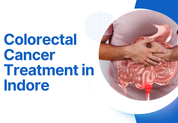 Colorectal Cancer Treatment in Indore