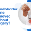 Is Gallbladder Stone Removed Without Surgery?