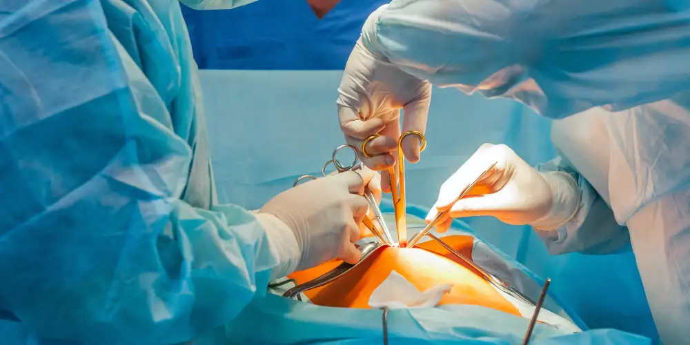 Gastroenterology Surgery