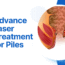 advance laser treatment for piles