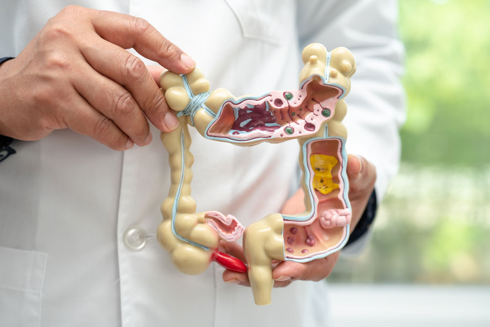 Advance Laser Treatment for Piles, Fissure, and Fistula: A Complete Guide to Pain-Free Recovery 2 colonoscopy follow up costs curasia