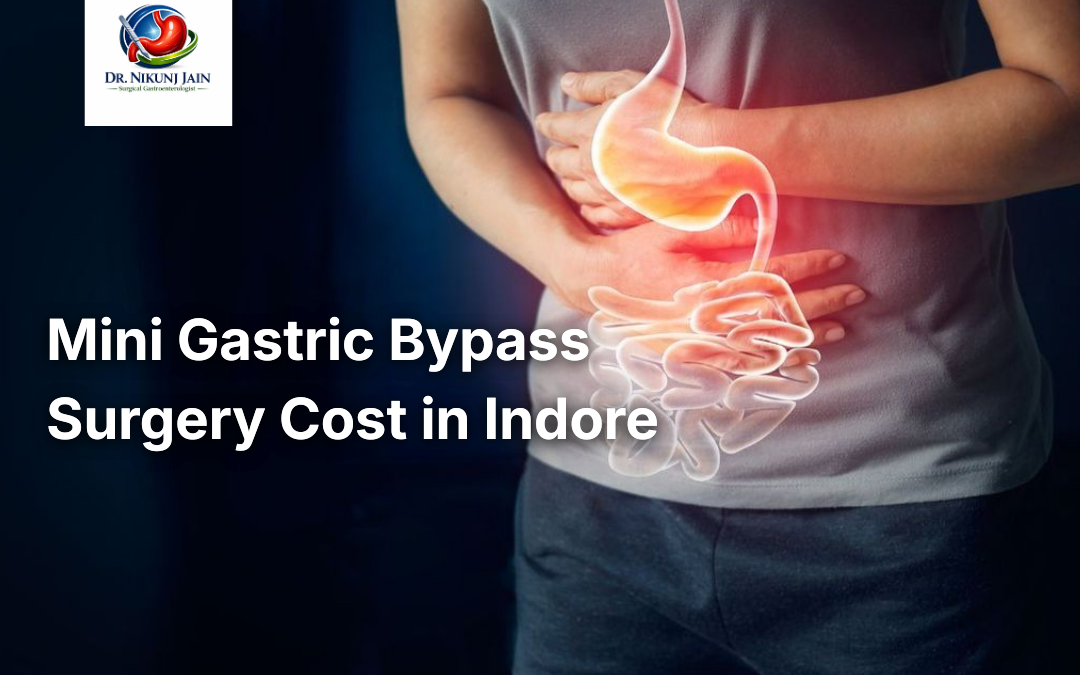 Mini Gastric Bypass Surgery Cost in Indore