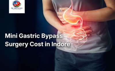 Blogs Mini Gastric Bypass Surgery Cost in Indore
