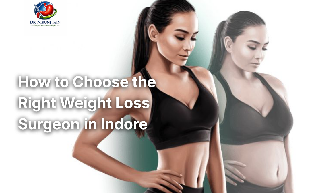 How to Choose the Right Weight Loss Surgeon in Indore