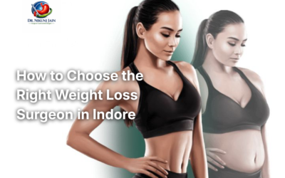 Blogs How to Choose the Right Weight Loss Surgeon in Indore