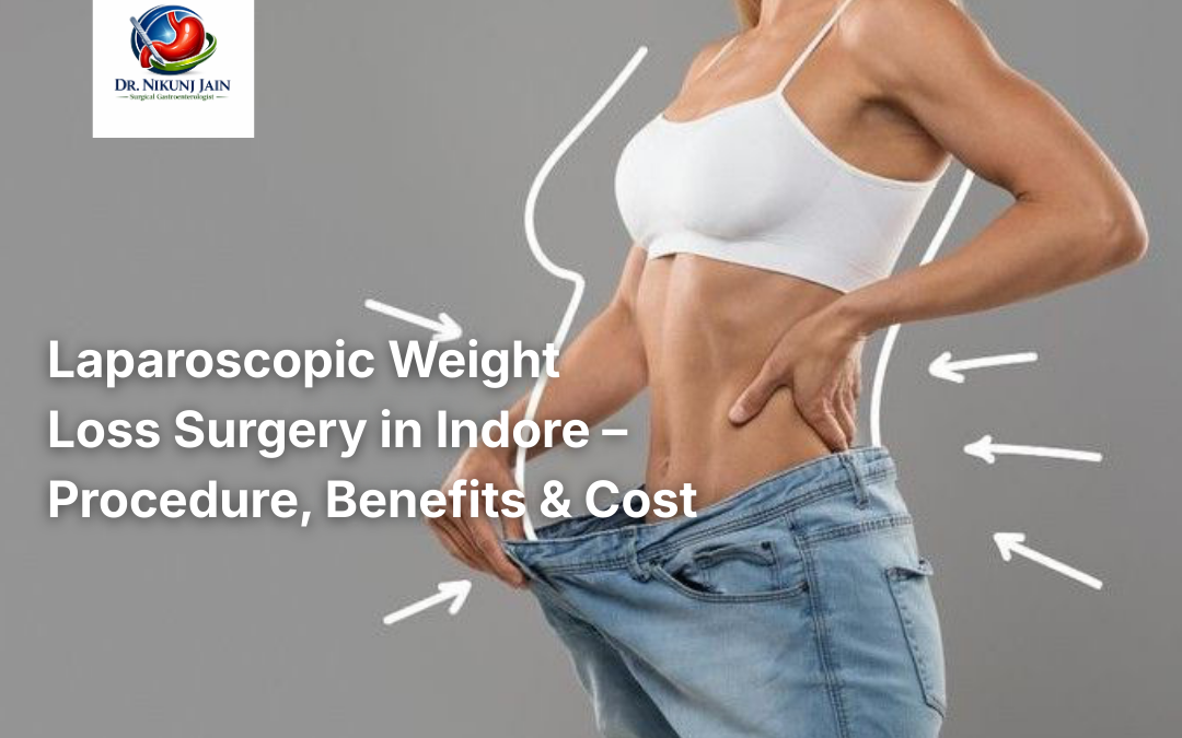Laparoscopic Weight Loss Surgery in Indore – Procedure, Benefits & Cost