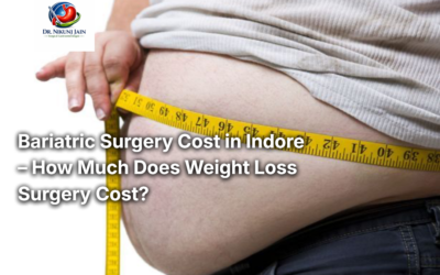 Bariatric Surgery Cost in Indore – How Much Does Weight Loss Surgery Cost?