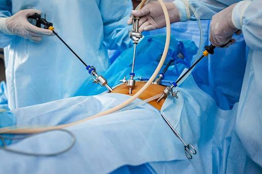 Best Laparoscopic Hernia & Piles Surgeon in Indore Hiatus hernia in indore Hernia surgeon in Indore Piles Surgeon in indore Fistula surgeon in Indore Fissure doctor in indore