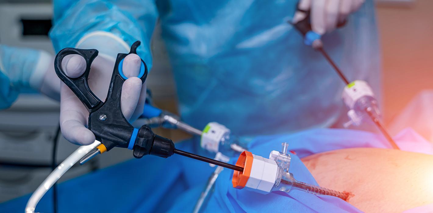 Laparoscopy Surgery by best laparoscopic surgeon Dr. Nikunj jain