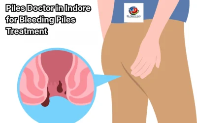 Blogs Piles Doctor in Indore for Bleeding Piles Treatment | Dr. Nikunj Jain