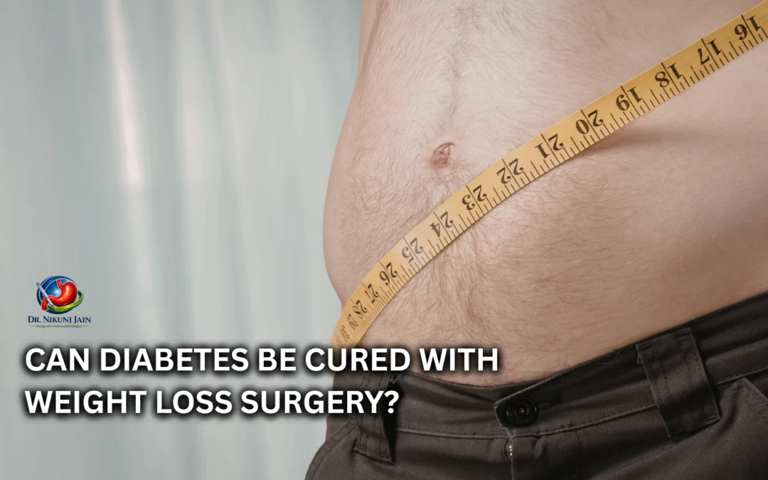 Can Diabetes Be Cured with Weight Loss Surgery?