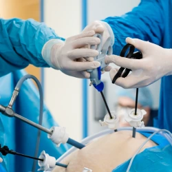 Laparoscopic Surgery in Indore Laparoscopic Surgery in Indore 2 2