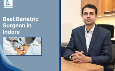 Best Bariatric Surgeon in Indore | Dr. Nikunj Jain