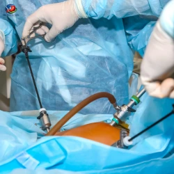 Is Laparoscopic Surgery Safe for Elderly people? Is Laparoscopic Surgery Safe for Elderly Patients 2