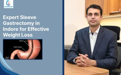 Expert Sleeve Gastrectomy in Indore for Effective Weight Loss