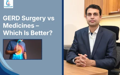 GERD Surgery vs Medicines – Which Is Better?