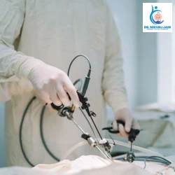 Laparoscopic Hernia Surgery in Indore 2