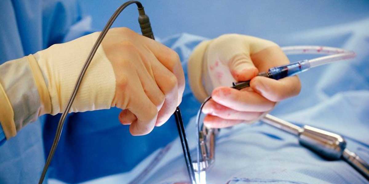 Dr. Nikunj Jain, best hernia doctor in Indore, best laparoscopic surgeon in Indore, hernia treatment in Indore, piles treatment in Indore, piles doctor in Indore, best piles doctor in Indore, gastroenterologist in Indore, weight loss clinic in Indore, weight loss doctor in Indore, best weight loss doctor in Indore, best bariatric surgeon in Indore, bariatric doctor in Indore, best weight loss surgeon in Indore